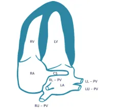Coronary Sinus view