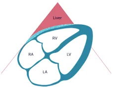 The subcostal four-chamber view