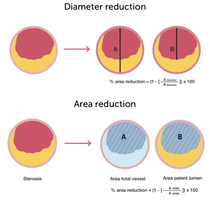 11.6_area_diameter_reduction