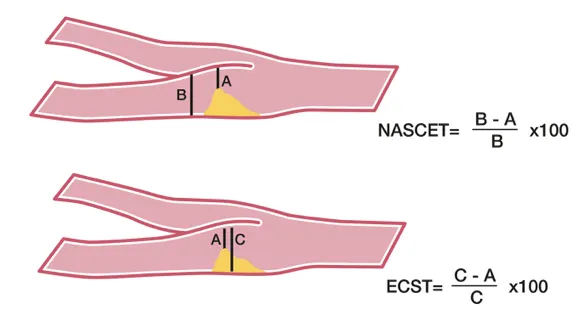 11.7_nascet_ects