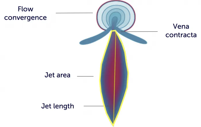Jet Components