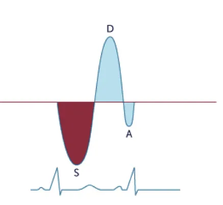 Systolic flow reversal