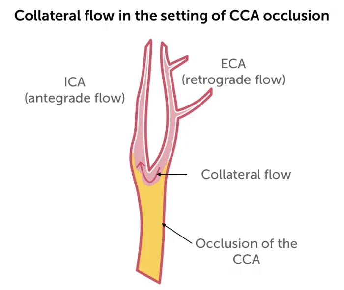 12.9_occlusion