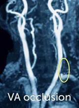 13.4_mri_va