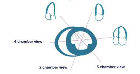 Orientation of the apical views in relation to the short-axis view