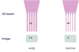 123sonography