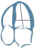 2d_measurements_4ch