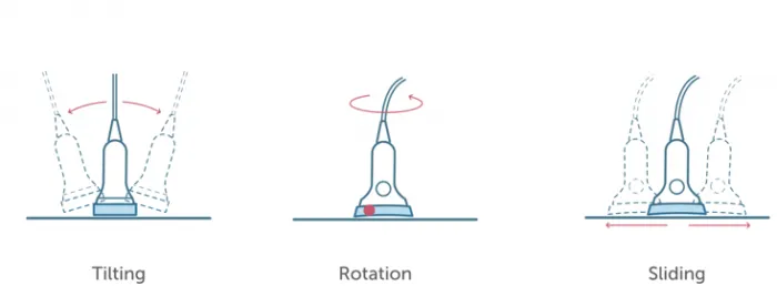 4.1_transducer_motion