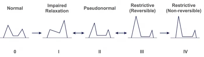 Diastolic dysfunction grading