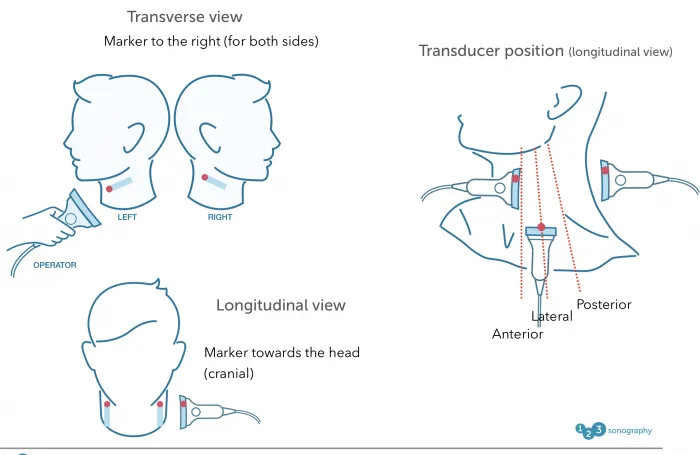 4.4_transducer_orientation