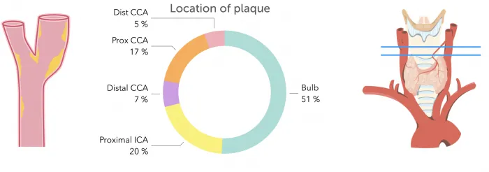 4.7_bifurcation_facts