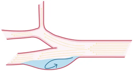 5.8_recirculation