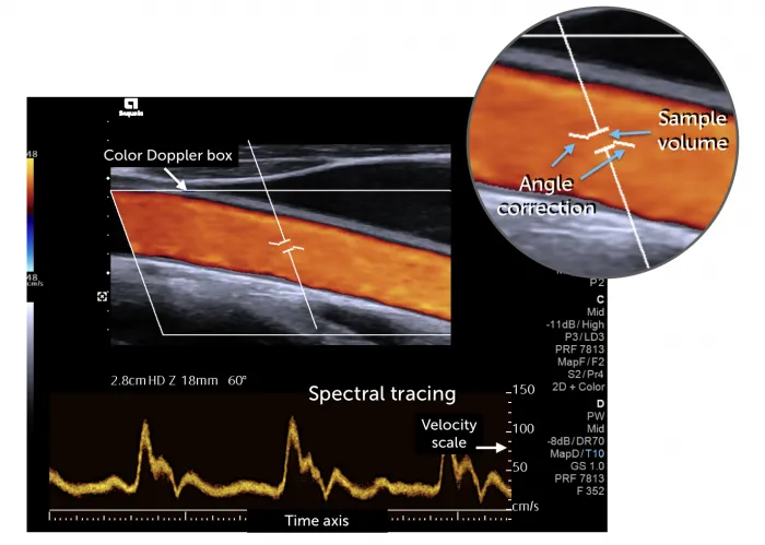 6.1_spectral_explain
