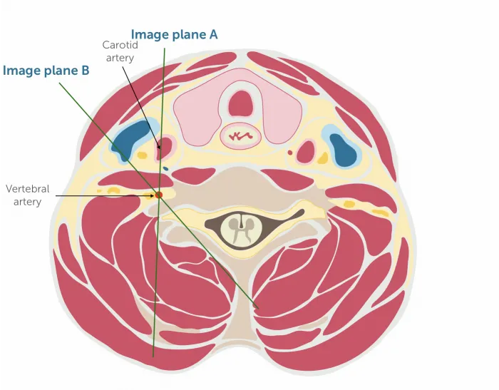 7.3_va_imaging_planes