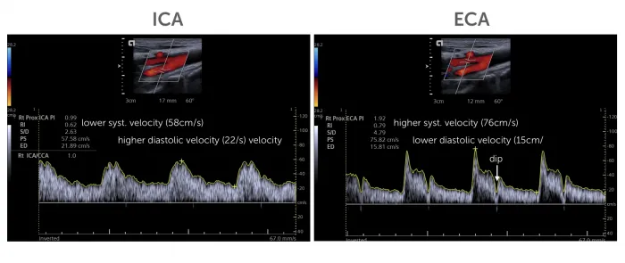8.10_eca_vs_ica_spectrum