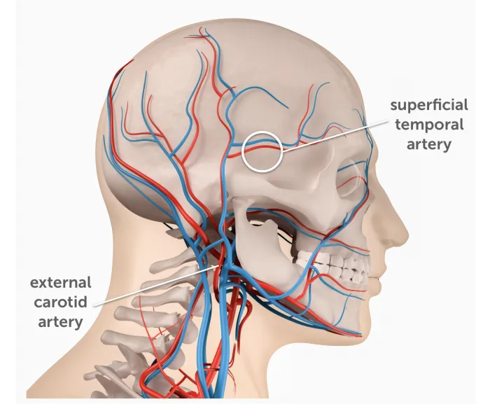 8.11_temporal_artery