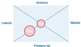 8.4_eca_ica_transverse