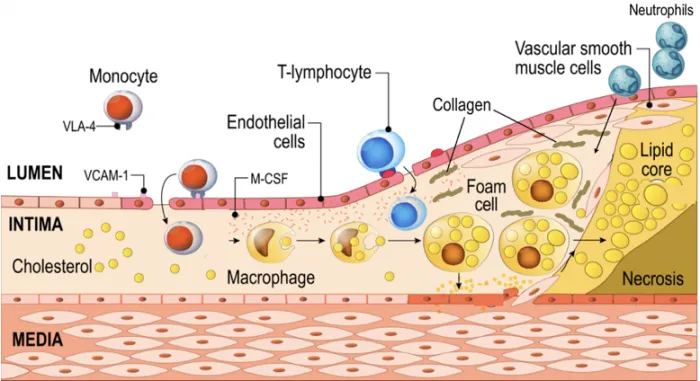 9.7_atherosclerosis