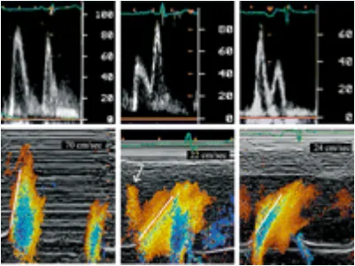 123sonography