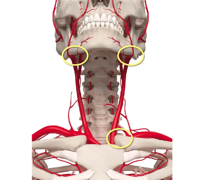 carotid-difficult