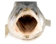 Diastole