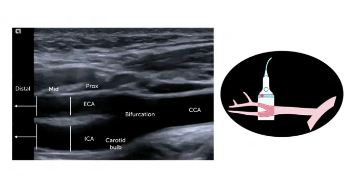 segments_of_the_ca