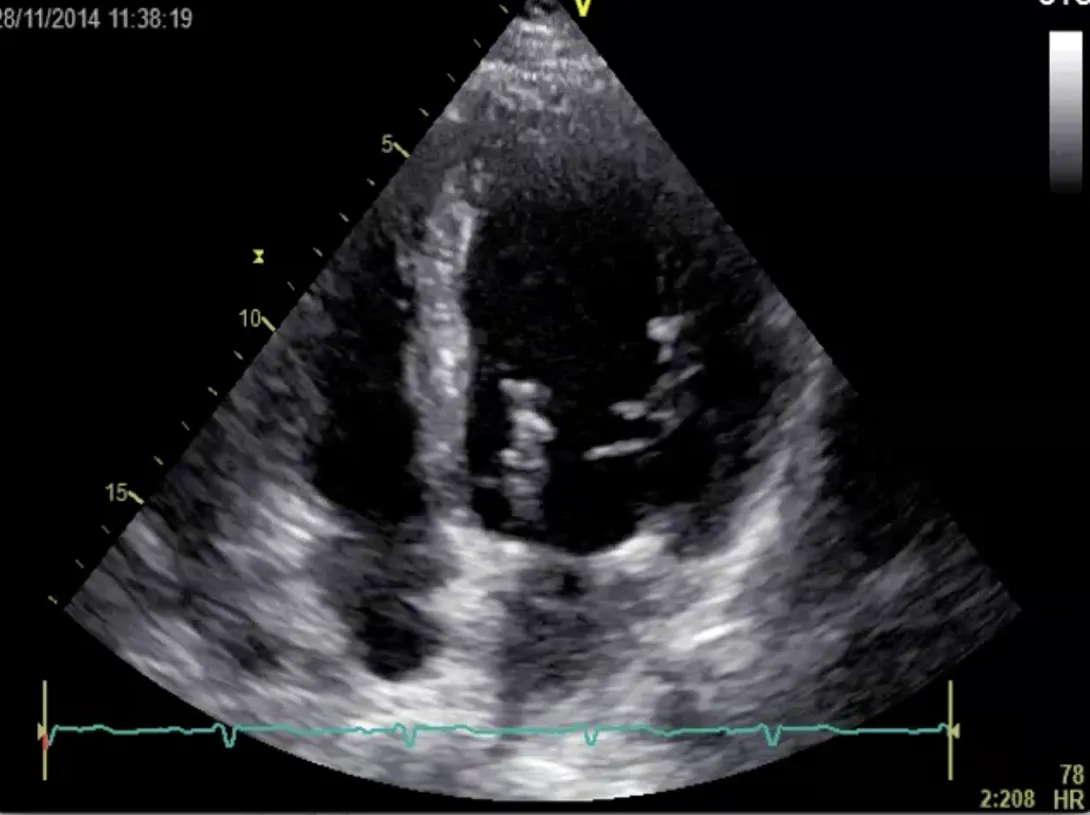 Beat the Heat Part 2 - Which procedure was performed in this patient?