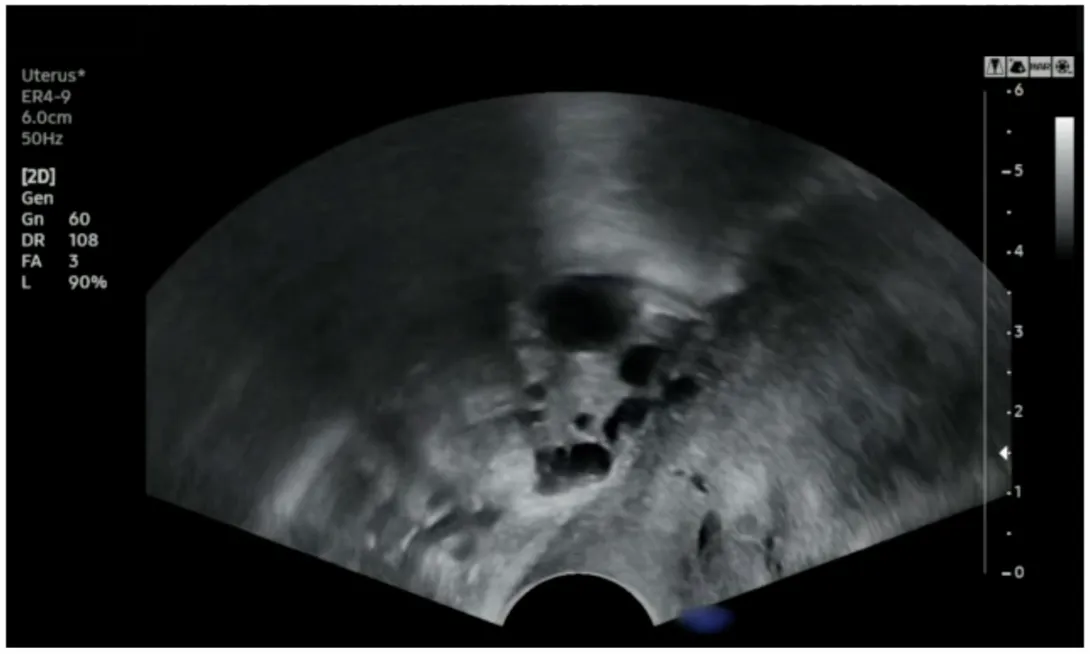 OB/GYN Ultrasound BachelorClass Case