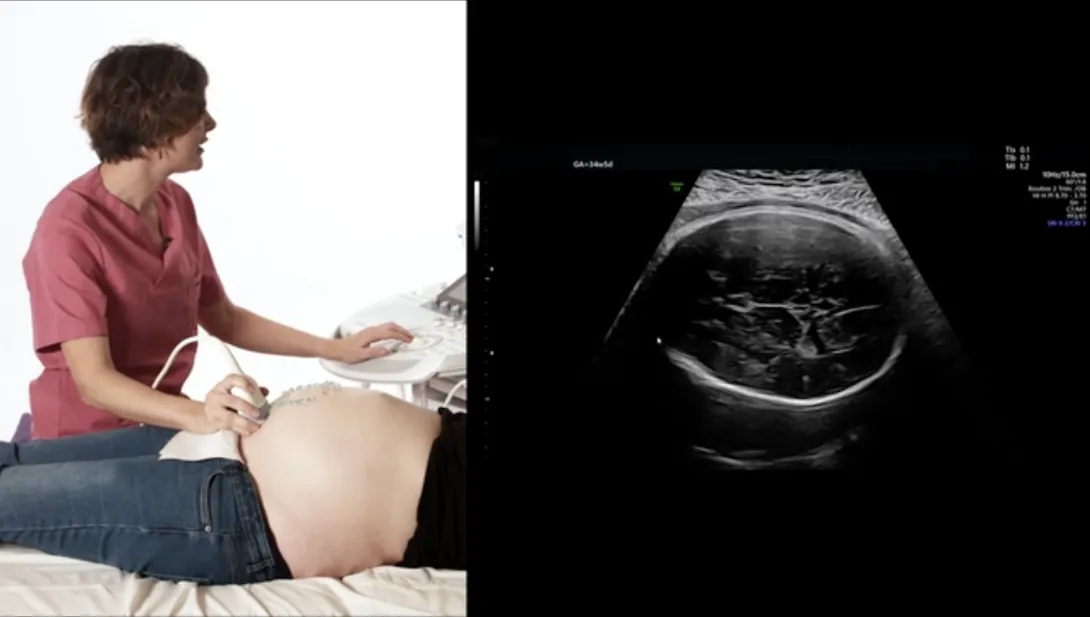 How to identify the fetal position in late pregnancy?