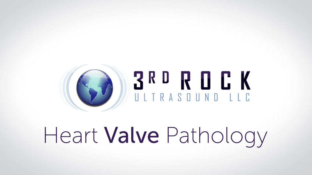 Heart Valve Pathology