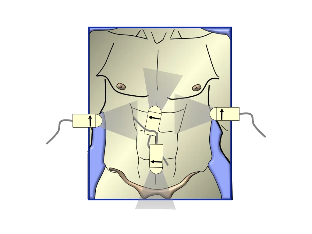 Trauma ultrasound