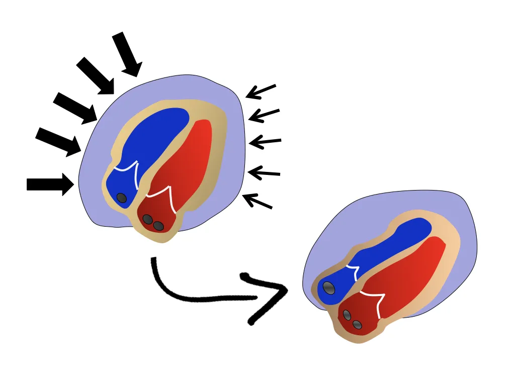 Cardiac Ultrasound