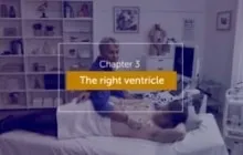 The right ventricle