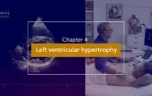LVH Quantification