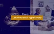 LVH Differential Diagnosis