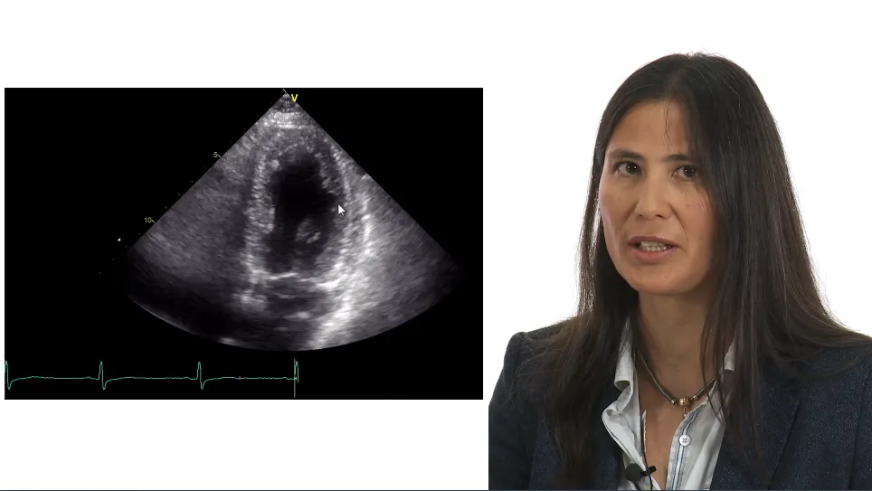 Coronary Artery Disease