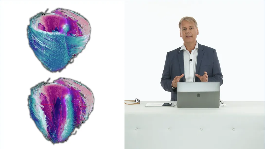 Myocardial Mechanics