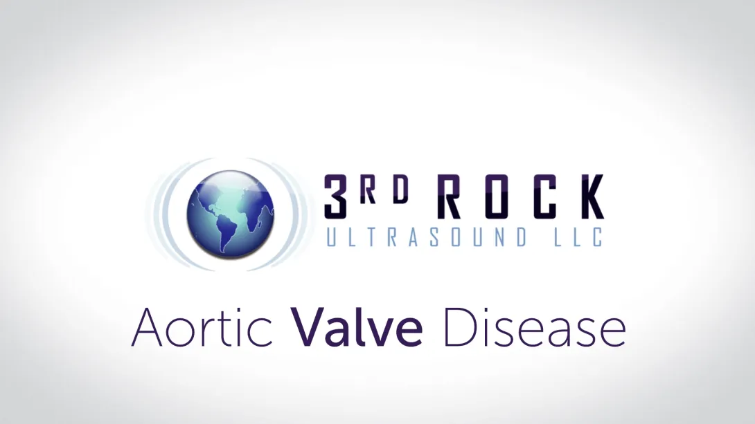 Aortic Valve Disease