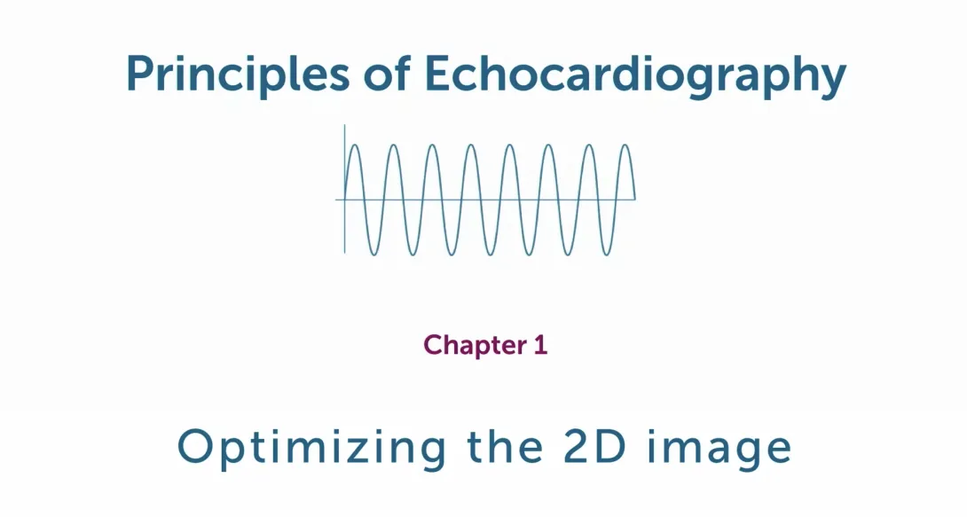 Optimizing the 2D image