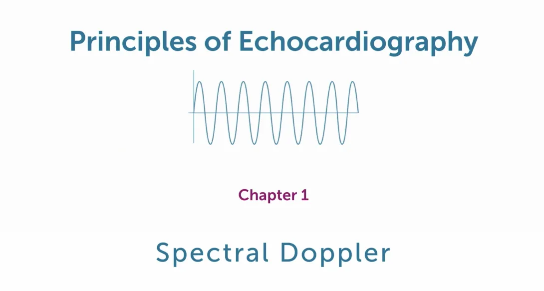 Spectral Doppler