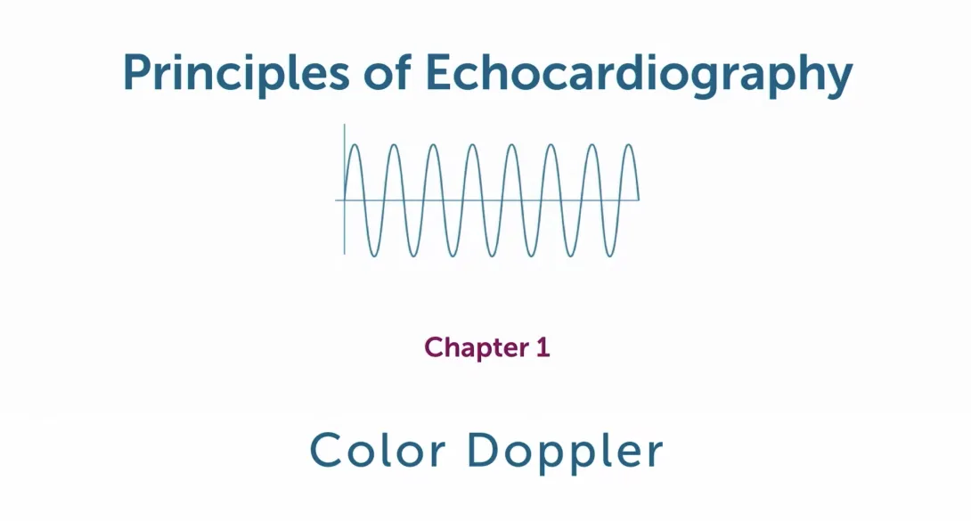 Color Doppler