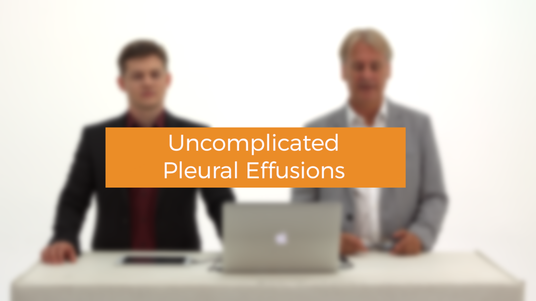 Uncomplicated Pleural Effusions