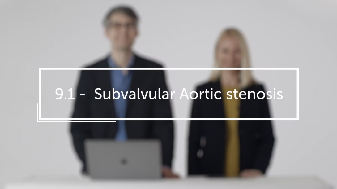 Subvalvular Aortic stenosis