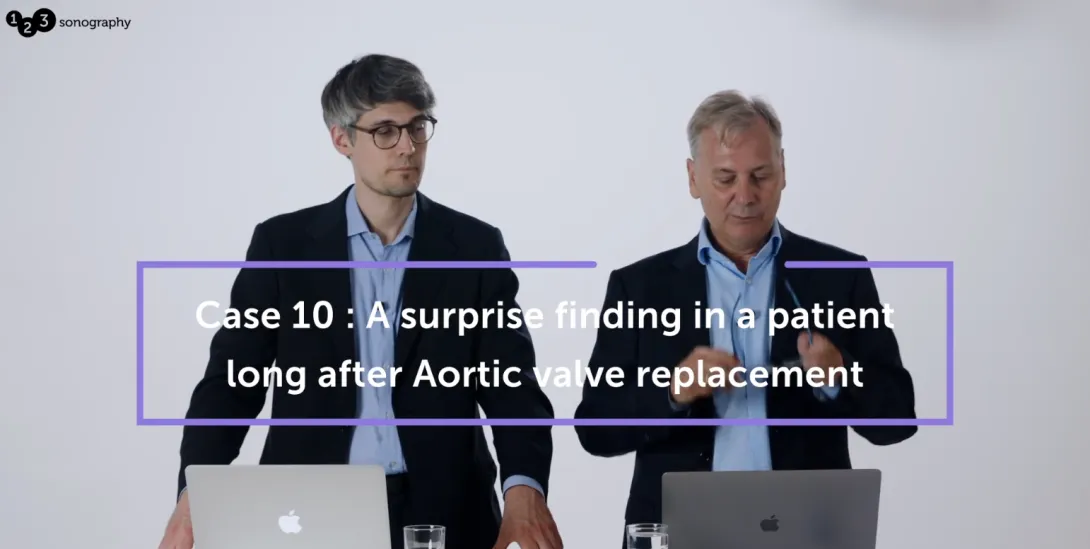 A surprise finding in a patient long after aortic valve replacement
