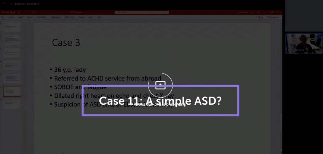 A simple ASD?