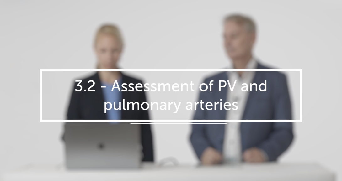 Assessment of PV and Pulmonary Arteries