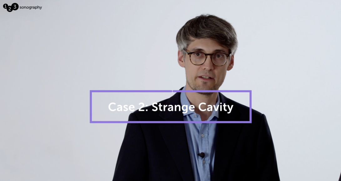 Strange cavity