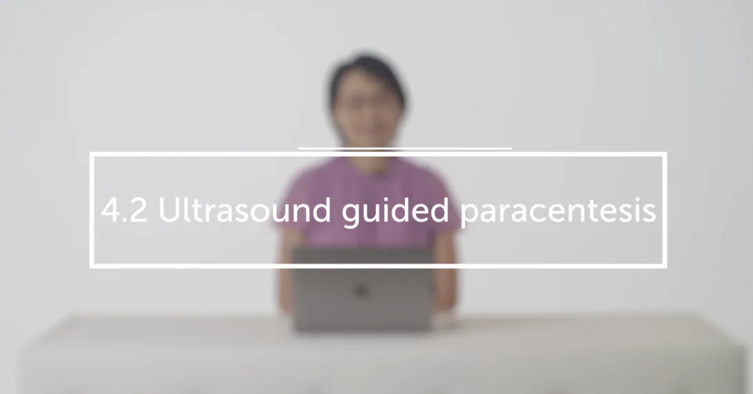 Ultrasound guided paracentesis