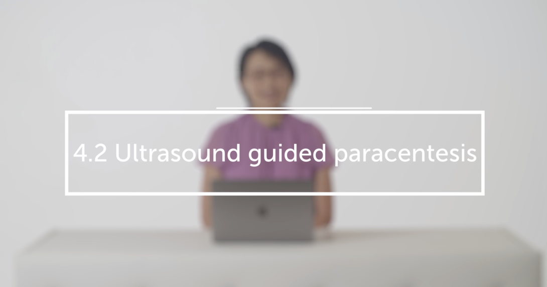 Ultrasound guided paracentesis