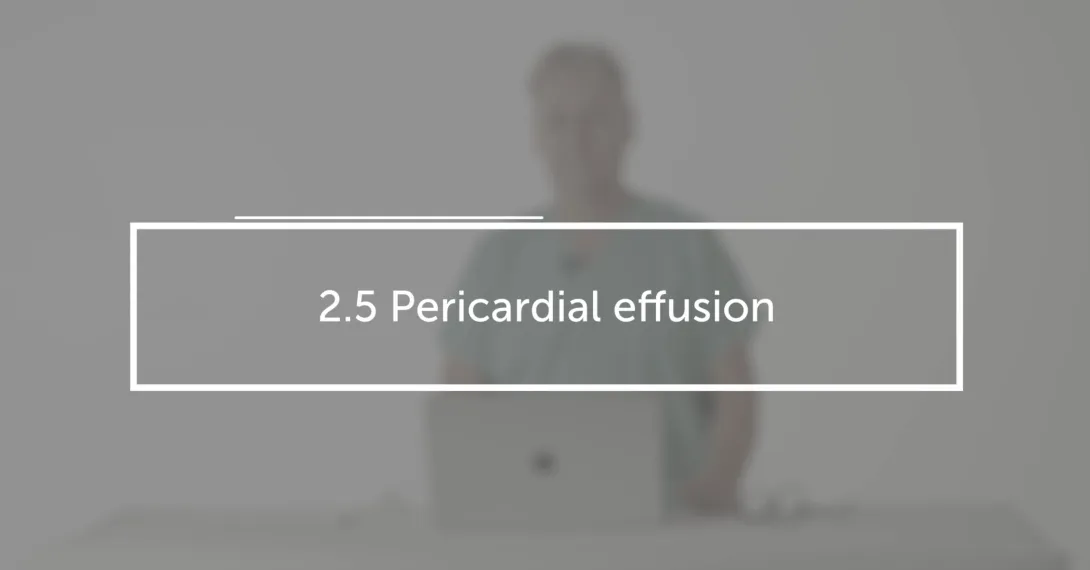 Pericardial effusion
